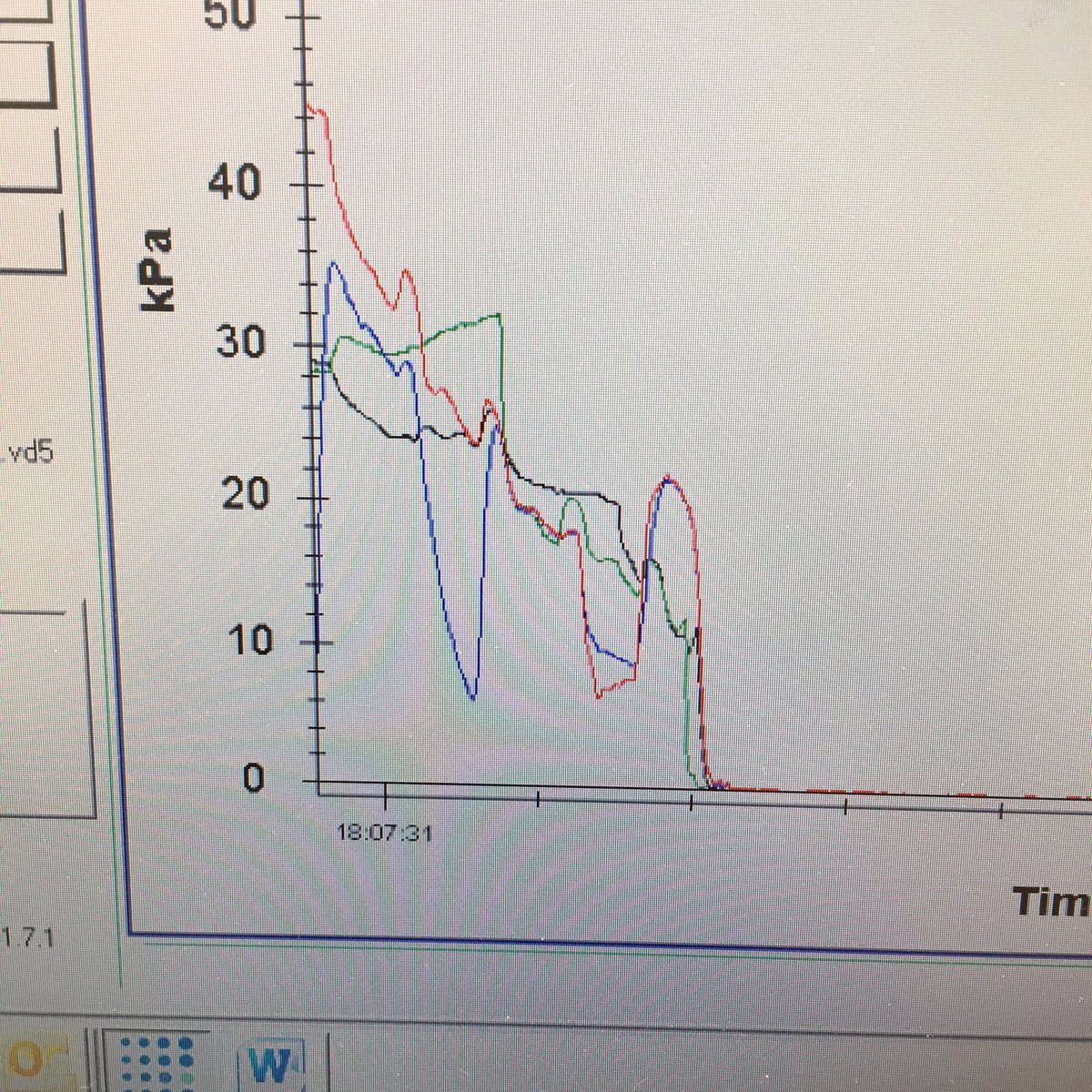 Precision_Milk's tweet photo. Today's issue: reverse vacuum gradients at the teat end in 68% of cluster detachments. #milkingtimetesting #teamdairy https://t.co/c095h0fQnu