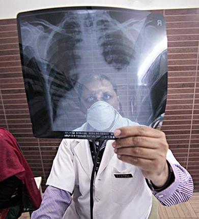 the_hindu's tweet photo. #WeekendBeing: The End TB strategy https://t.co/APpohcn3MJ #tuberculosis https://t.co/W2HMGxzWgP