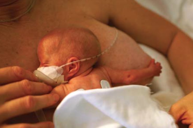 Thumbnail for Dr. Uwe Ewald on breastfeeding promotion in a Swedish NICU