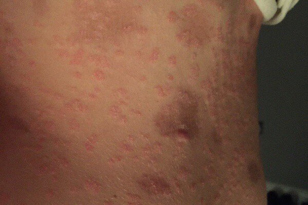 michellesartai4's tweet photo. I'm raising money on GoFundMe. Please support me: https://t.co/pYeLOlXC4S @gofundme https://t.co/hHrHJnbAEA
