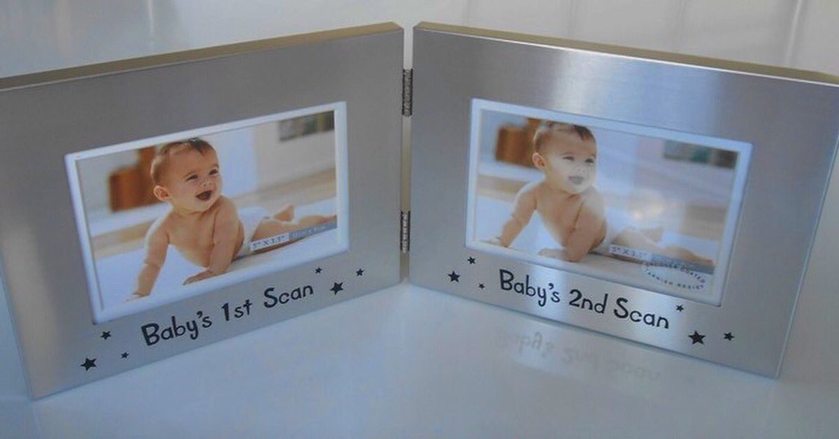 BabyCarousel_'s tweet image. Double scan aluminium photo frame @BabyCarousel_ #babyscanframe #babykeepsakes #babygiftideas #babygifts #underafiver