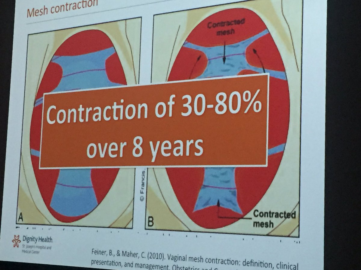 PelvicGuru1's tweet photo. #Mesh injuries. Major issues with Prolift, but also can have nerve and muscle injury from TOT and TVT #IPPS16 #IPPS2016
Dr. Castellanos https://t.co/zjYkQbD29B