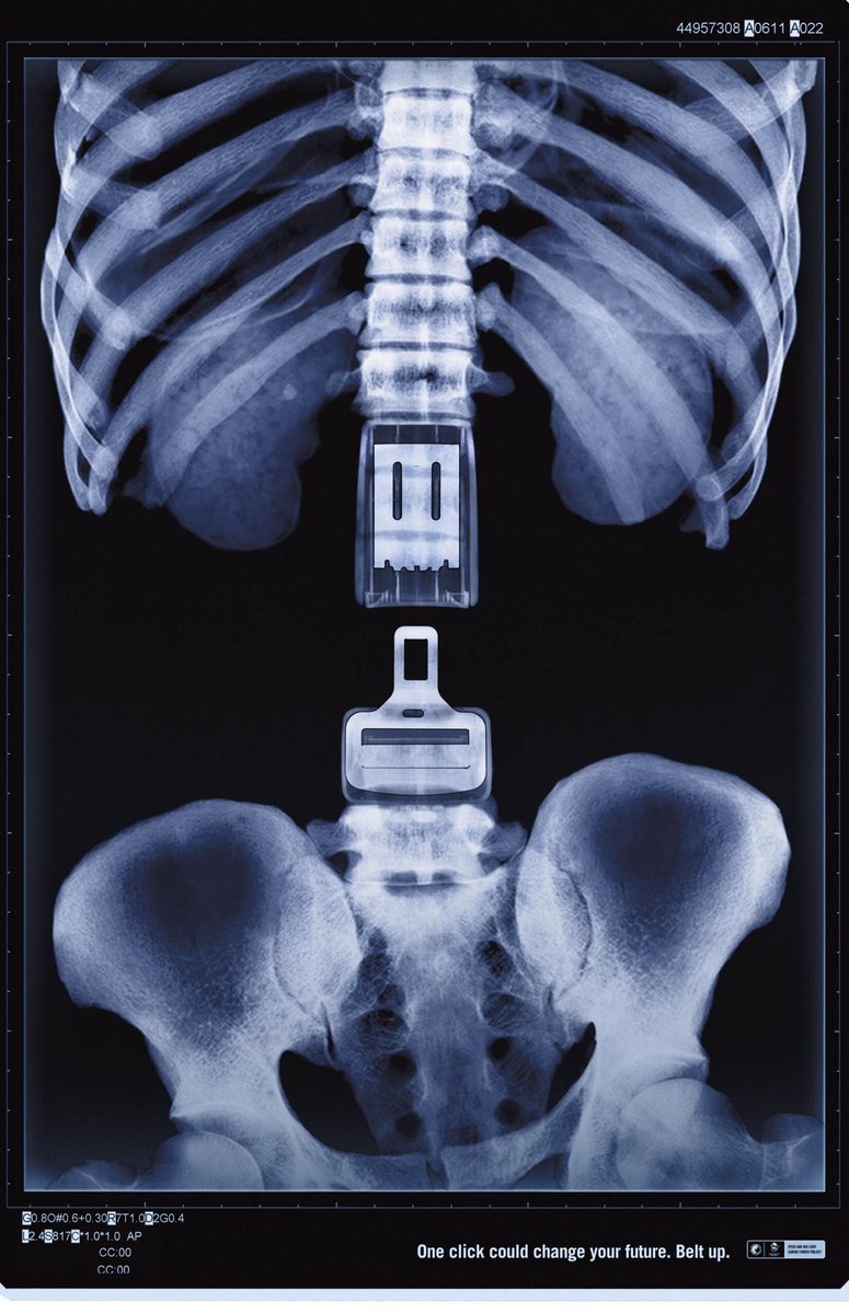YourInitiatives's tweet image. It doesn't matter how short your journey is, ALWAYS wear a seat belt! #ClunkClick #RoadSafety via @dharford79