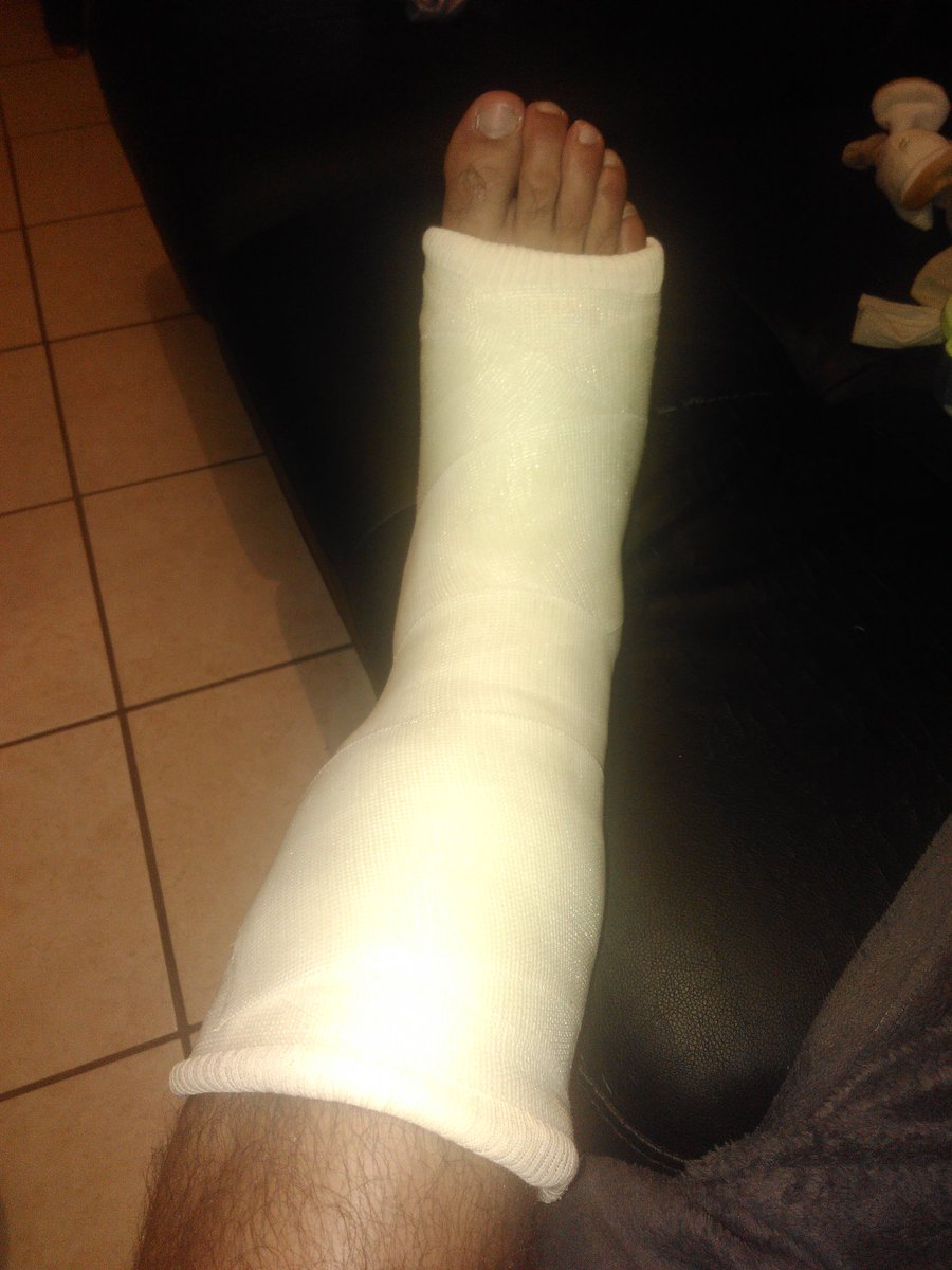 NoanPelcat's tweet photo. Au final j'ai quelque chose beaucoup de casse #DoubleFracture https://t.co/TFojjFCnci