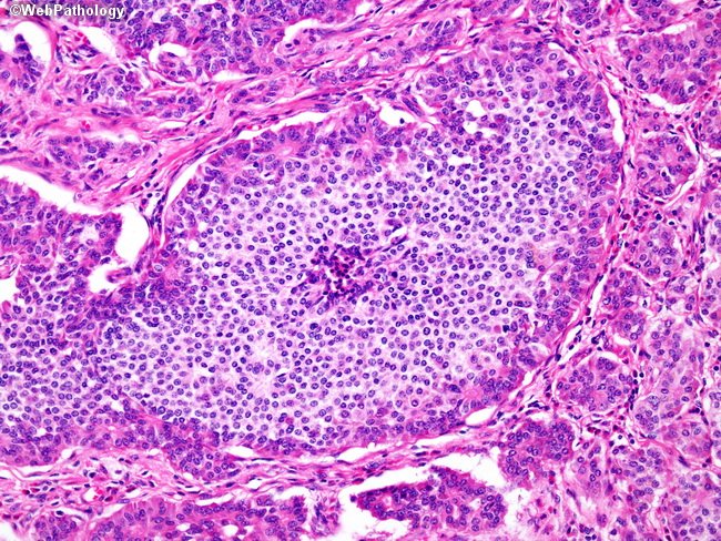 JNCI_Now's tweet photo. Evidence showing that tumors can grow without angiogenesis: https://t.co/VV86AIu8Gf https://t.co/iNFljbgc3f