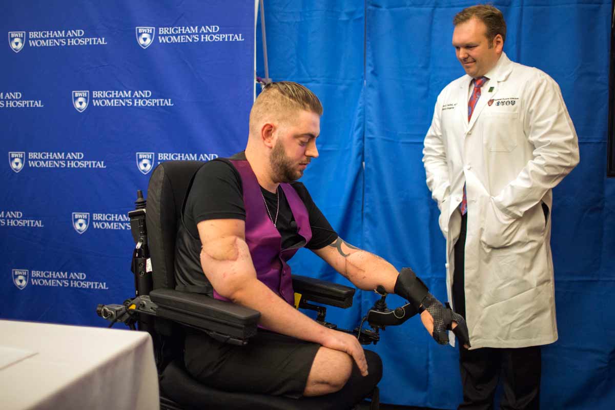 шрейя сидданагоудер. трансплантация конечностей. пересаженные конечности. пересаживают ли руки. пересаживают ли руки.