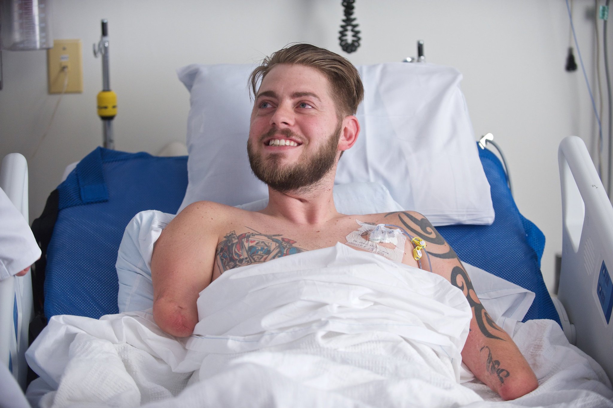 Retired USMC Sergeant John Peck eagerly awaits his bilateral arm transplant at BWH