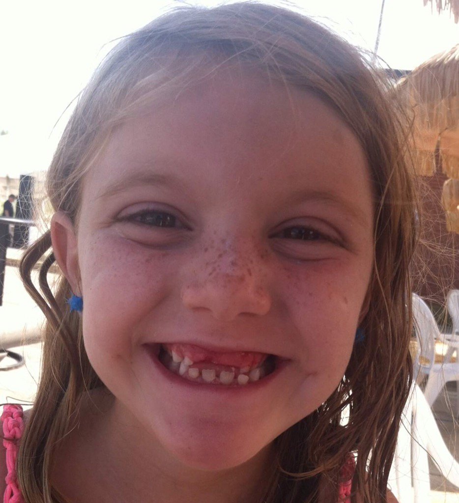 jennloftis's tweet image. All of us girls at 7 1/2 yrs! The apple doesn't fall far from the tree! #missingfrontteeth