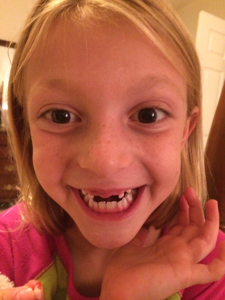 jennloftis's tweet image. All of us girls at 7 1/2 yrs! The apple doesn't fall far from the tree! #missingfrontteeth