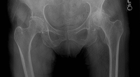 ChicharroJL's tweet photo. La carrera es un factor de riesgo en el desarrollo de osteoartritis (BLOG JL Chicharro) https://t.co/MlGSQ89LzP https://t.co/l5Rotd76uX