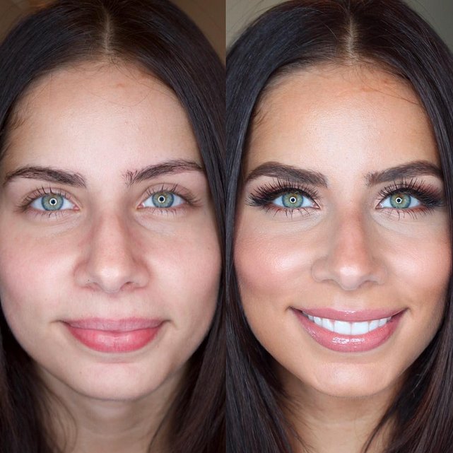 Wigmore Medical on Twitter "A stunning transformation from