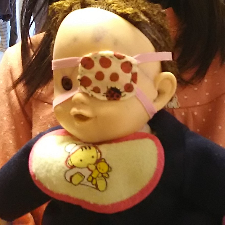 てんとう虫柄の手作り眼帯