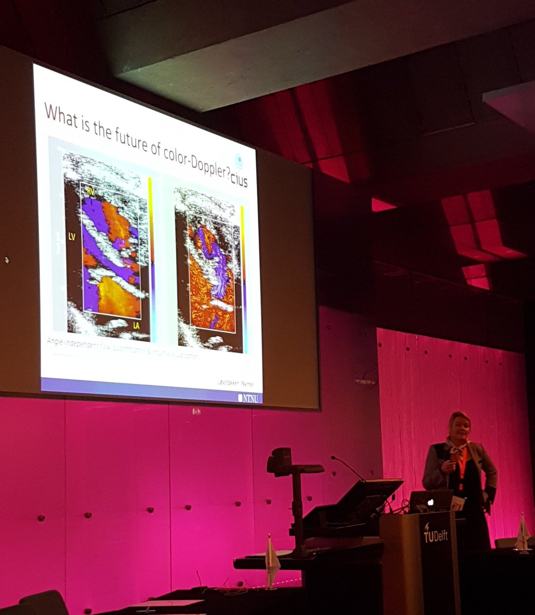 amikisz's tweet photo. Fantastic images of blood flow using advanced echo technology by Toril Nagelhus from @SINTEF @iSMIT2016 https://t.co/5MnhY0MtWy
