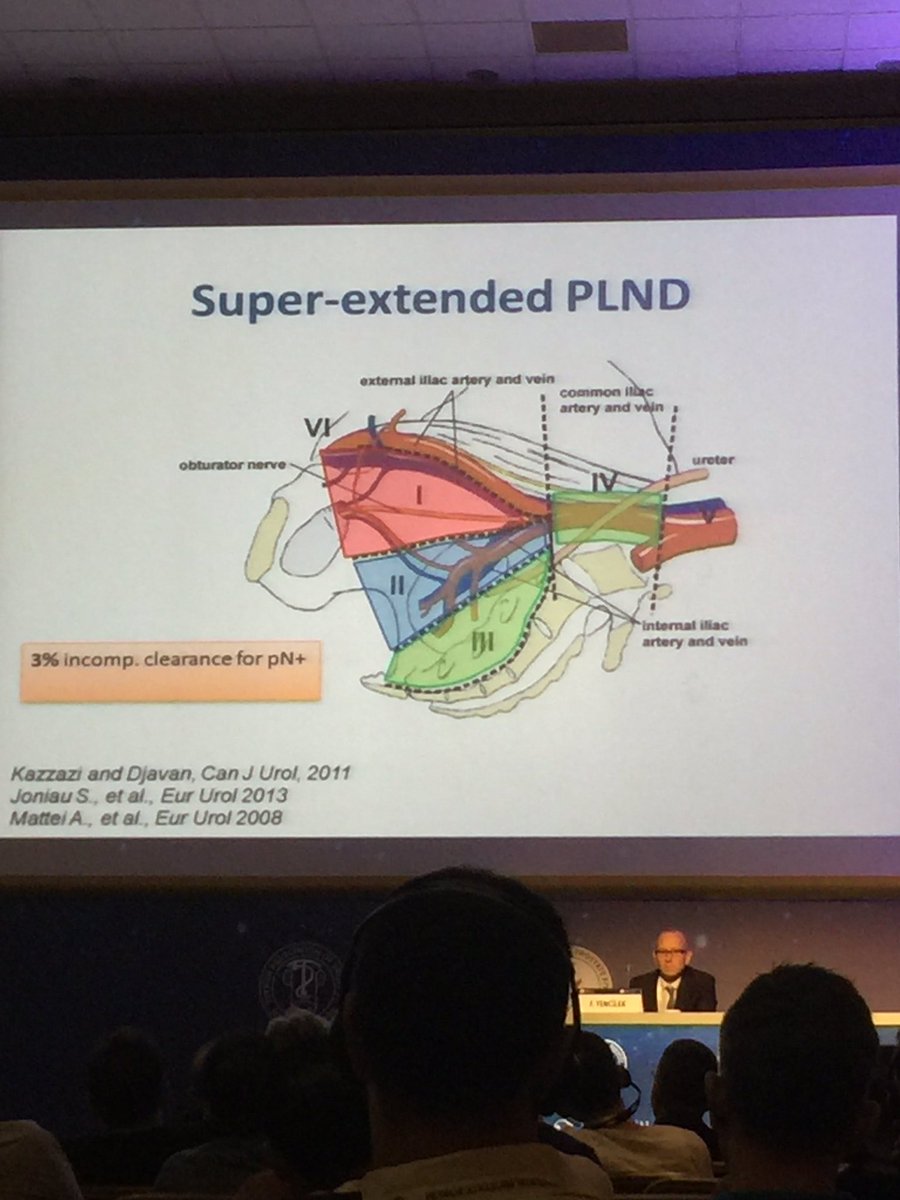 selcukurolog's tweet image. #indications #lymphnodedissection #prostatecancer @Uroturk #uroturk16 @BobDjavan @Uroweb #eauguidelines16