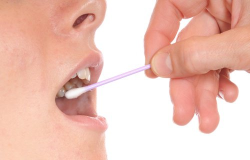 Una forma sencilla y eficaz de detectar el riesgo de caries dental 
m.europapress.es/andalucia/mala…
