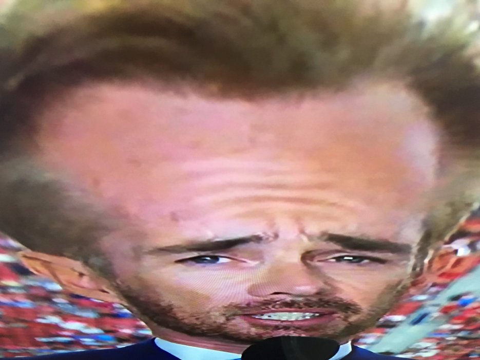 Big Cat Ar Twitter Favorite Headline Of The Day Joe Buck Almost Lost His Broadcasting Career Due To Hair Plug Addiction Https T Co Ykhv7vvg2m Https T Co Efzwctotgn Twitter