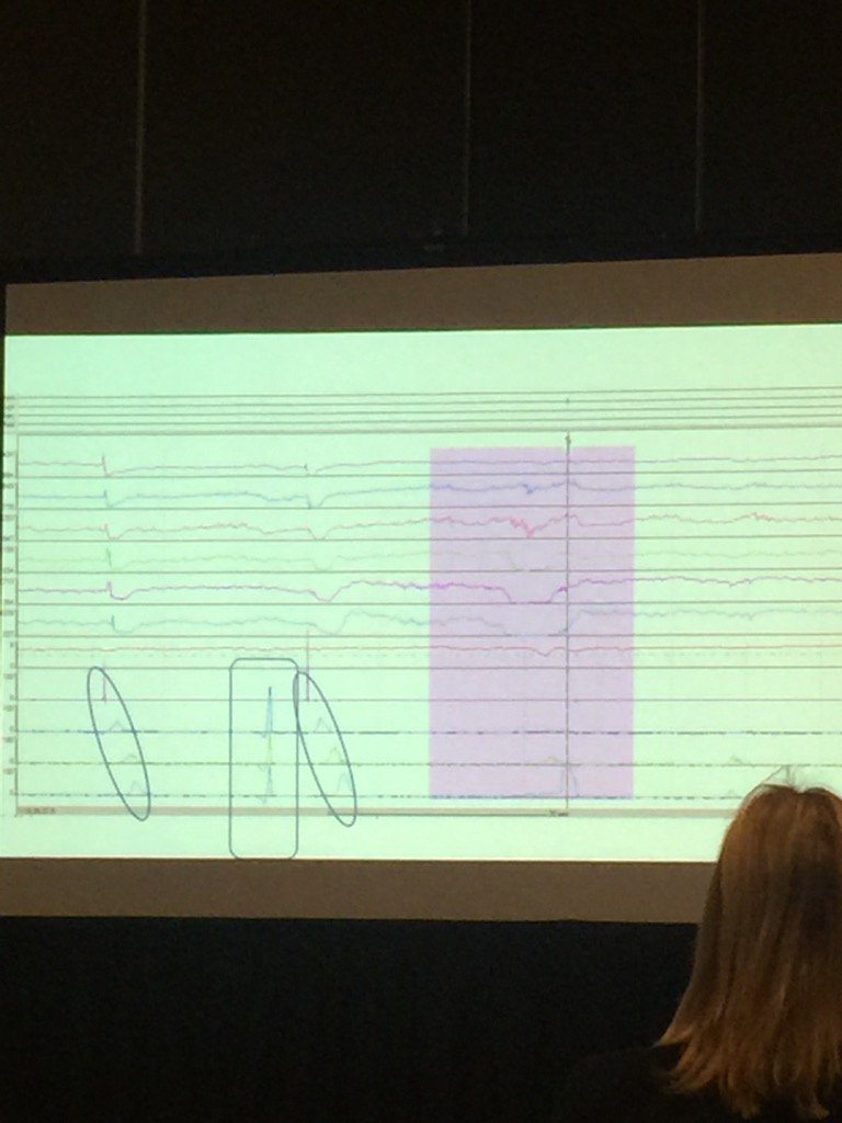 Anil Darbari tweet media