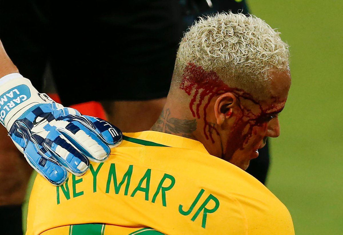 SportsCenter's tweet image. Neymar had to be subbed out after receiving an accidental elbow to the head.