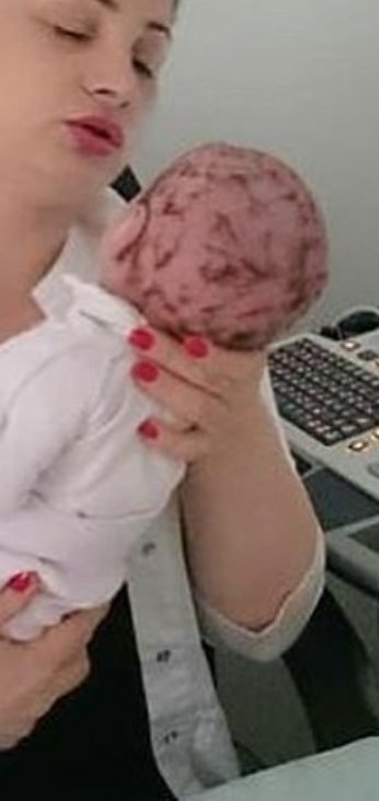 Я извиняюсь, но какие дебилы родители так побрили голову ребенку, бедный ужас