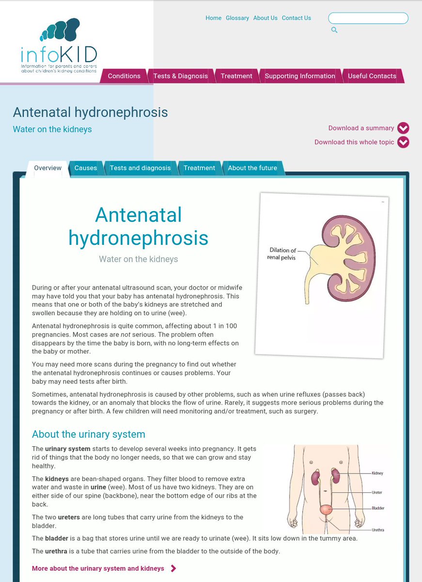 BAPNnephrology's tweet photo. Concerned about being diagnosed with antenatal hydronephrosis? Patient information written with families #InfoKID

https://t.co/Acry6uBeUt https://t.co/dmUPJyKmgx