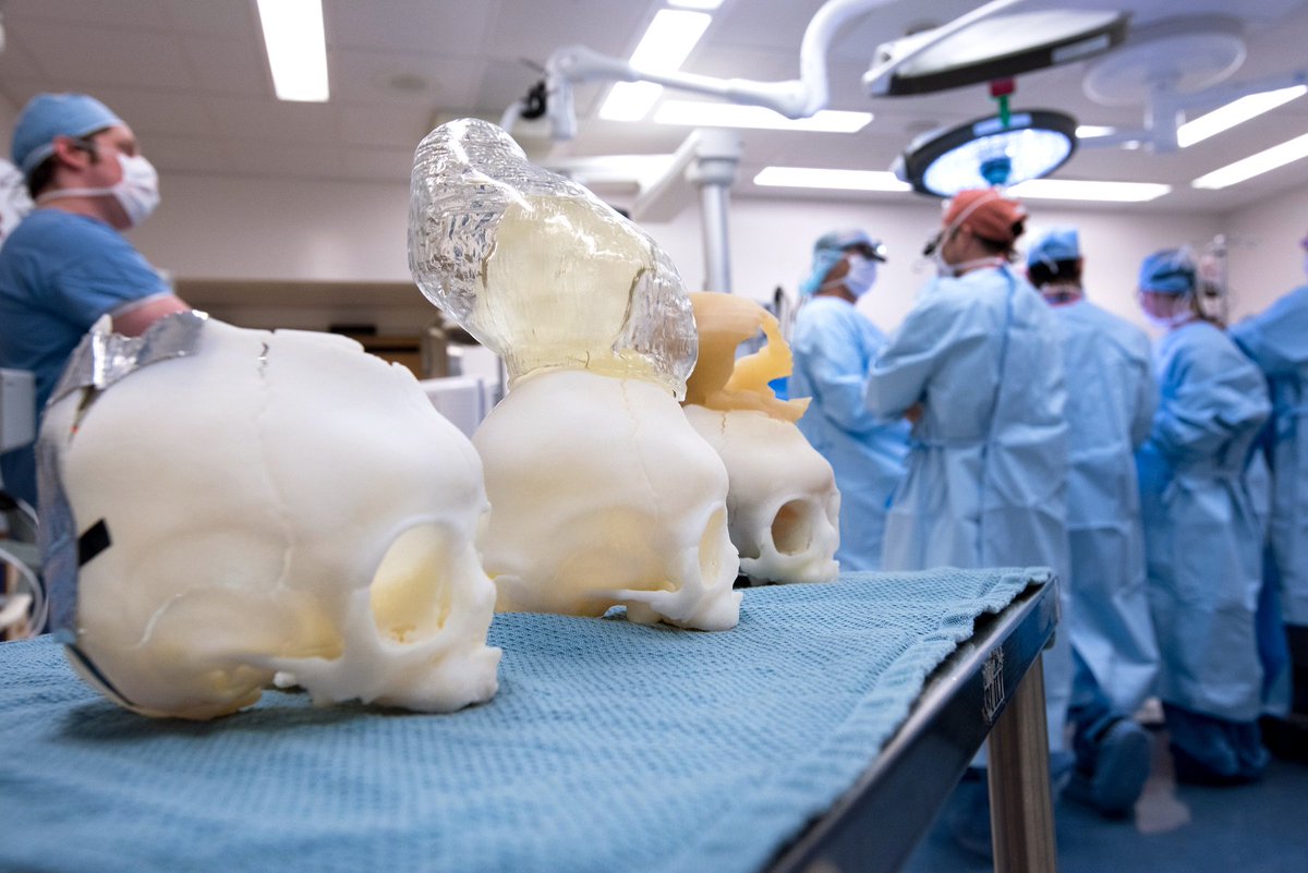3DAlpha_Imaging's tweet photo. 3D Printing is being used to save lives at Boston Children's Hospital: https://t.co/O0hxzODWOt https://t.co/Jmr3osepwh