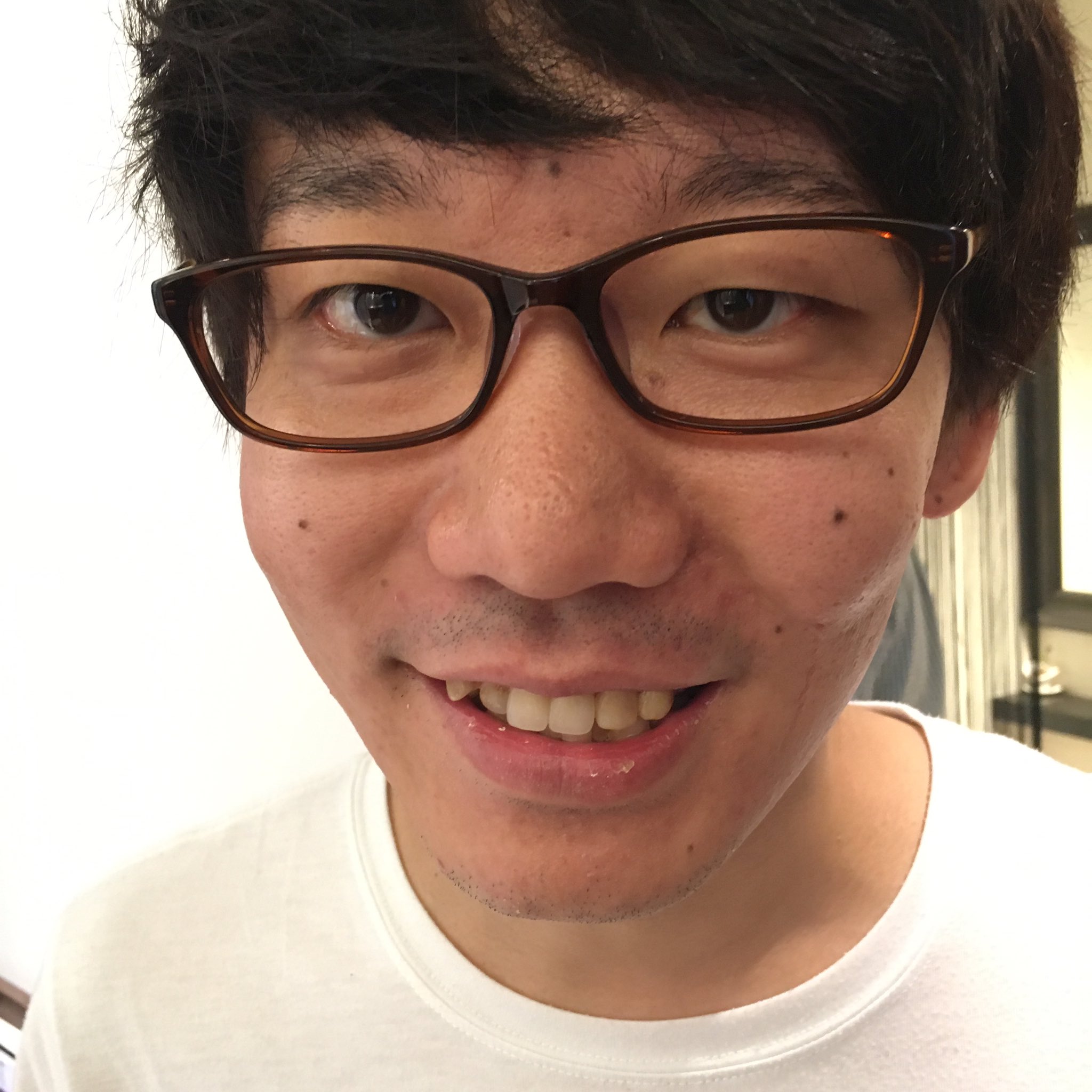 おかゆ 歯並び悪い人が好き過ぎるから 歯入れなくてもって思ったけど 思ってたより違和感なくて 普通にイケてて驚いた Rt Sanshiro Aida 三四郎のオールナイトニッポン0 重大発表は前歯の補填でした 三四郎ann0 T おかゆ 歯並び悪い人が好き過ぎるから 歯入れなくてもって思ったけど 思ってたより違和感なくて 普通にイケてて驚いた Rt Sanshiro Aida 三四郎のオールナイトニッポン0 重大発表は前歯の補填でした 三四郎ann0 T