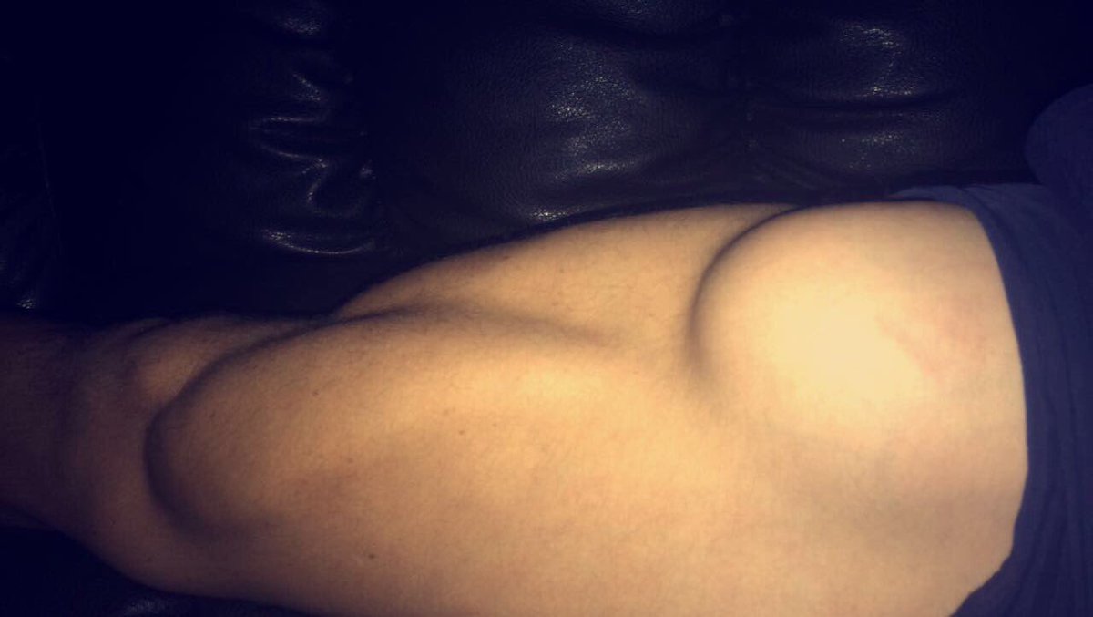 grizisaac's tweet photo. so for those of you that have been concerned about my thigh i went to the doctors to get it checked and it turns out i have a baby growing😤👶 https://t.co/NrCUBruitg