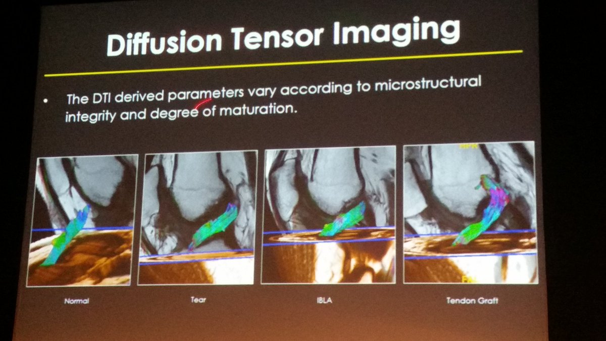 Paul_BORGinsole's tweet image. #PieterVanDyck #UZA #DiffusionTensorImaging #DTI #sportcongreskempen  #innovation in #Imaging