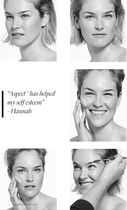 SkinMatrix's tweet photo. Did you know #AspectDr B serum is perfect for this time of year? Strengthens & Brightens the skin! https://t.co/z8FVREWegB