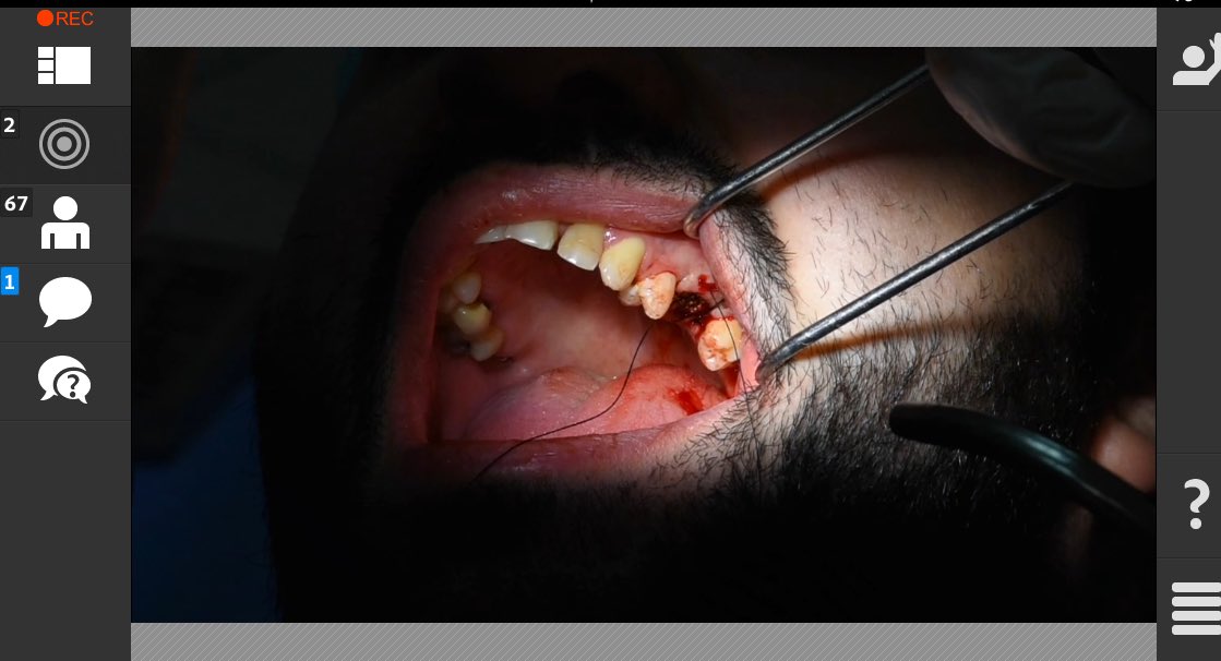 dent_GDSA's tweet photo. Suturing! 
#Live_Surgery 
1st Virtual Students Dental Conference. 

#GDSA #VSDC 2016 https://t.co/74wWgkIoYX