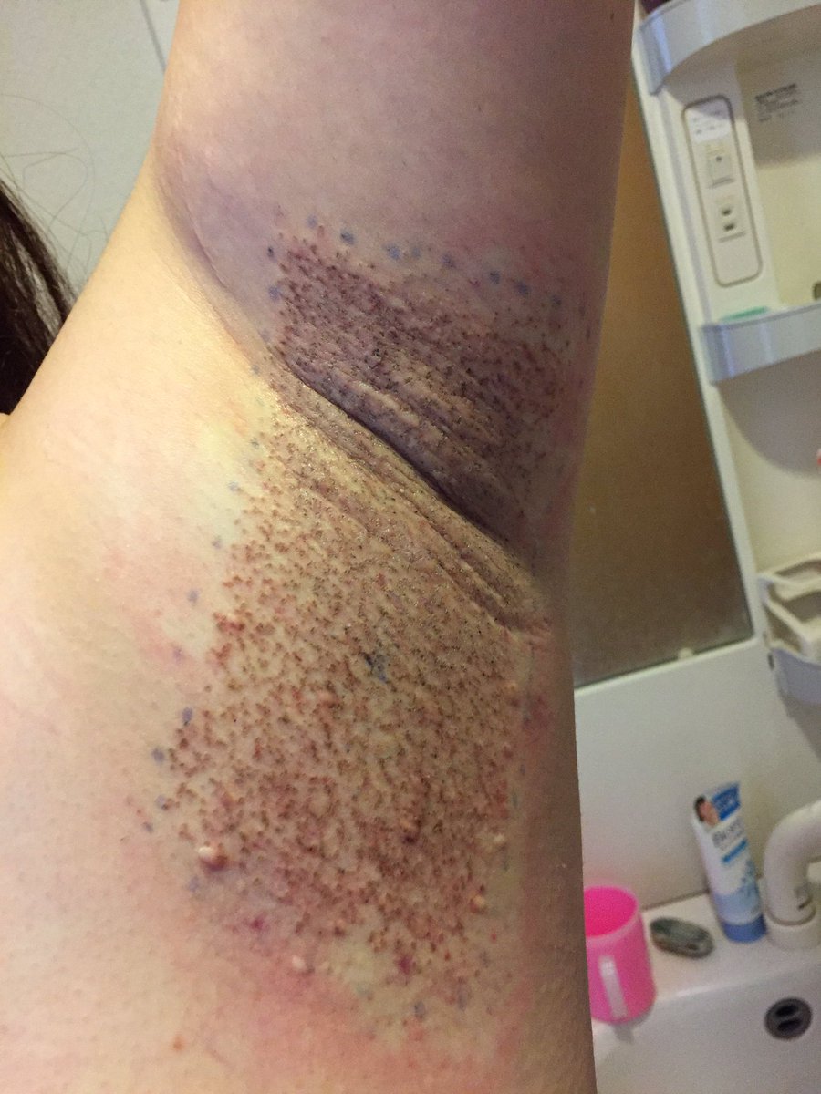 ワキガール ビューホット受けました Wak1gail Twitter