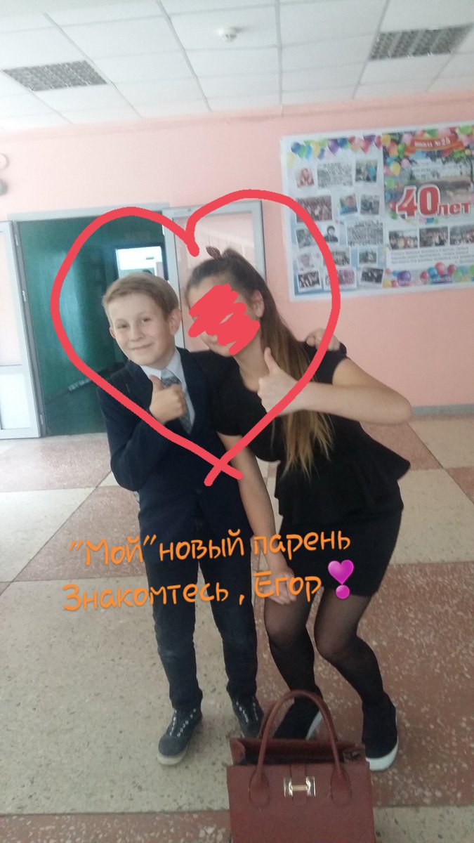 Как убрать вену под глазом