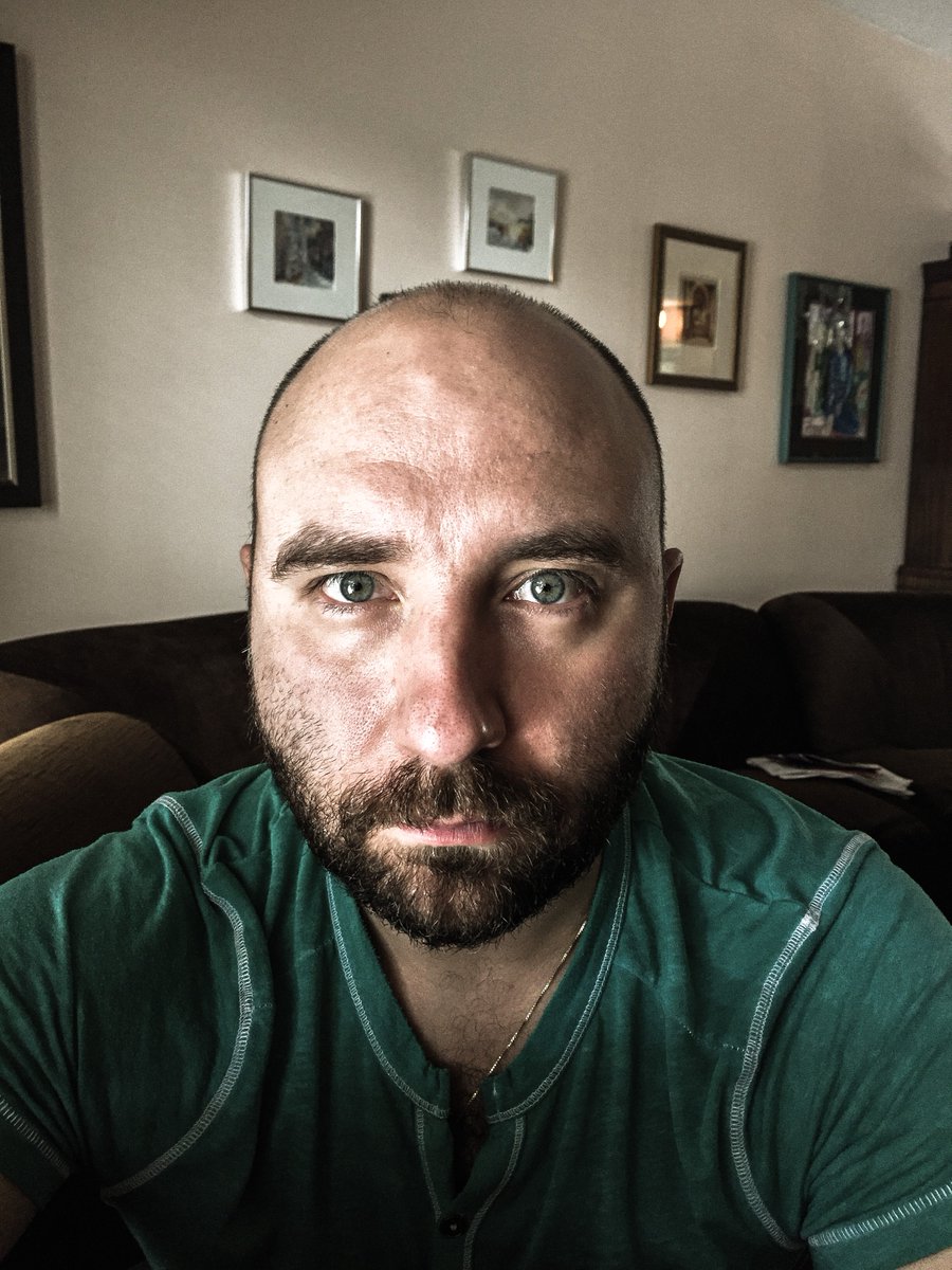 New self portrait series Titled: 'I'm Bald, and I'm Never Smiling Again.' #baldmen #balding #SadFace