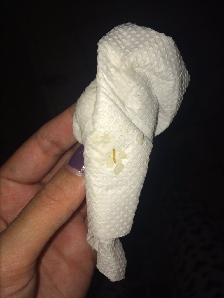 aoiferafter_'s tweet photo. @lidl_ireland live maggots and a weevil in the rice you sold me! No reply to my email sent 4 days ago! #LIDL #vile https://t.co/vP3EnCmXgD