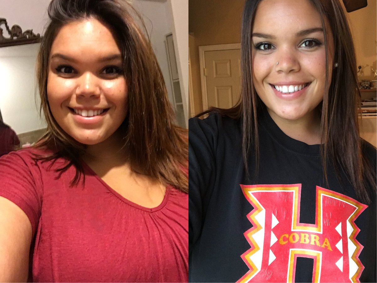 Jessiicaaxxo's tweet photo. So I've lost over 100 pounds and I'm still goin 😁🙌🏼 https://t.co/NBdh3DMRXw
