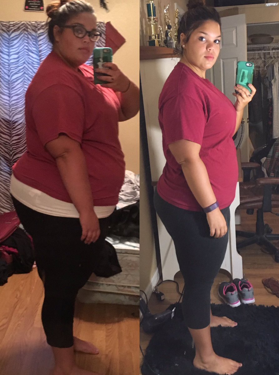Jessiicaaxxo's tweet photo. So I've lost over 100 pounds and I'm still goin 😁🙌🏼 https://t.co/NBdh3DMRXw