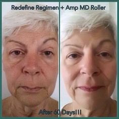 RFSkinHolly's tweet photo. Look at her skin! What results like these? Message me! Rodan+Fields #Multimedtherapy #RFBlossomandglow https://t.co/k067AiCrXQ