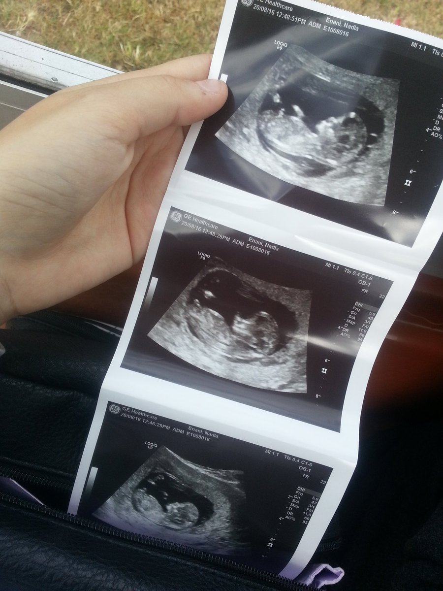 Nadia97Enani's tweet photo. 😍👶💜💙 https://t.co/rJLkFAvFMH