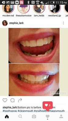 sweetthoneyplz's tweet photo. #toothspray
#oralhealth
#mouthwash
#cleanmouth
#happymouth
#Toothfilm
Got it for free to review
It is a natural product, I love it. https://t.co/ikYcuYSWVZ