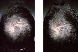 ResulteSA's tweet photo. fact: AHK-Cu stimulates hair growth by increasing the proliferation of dermal papilla cells, and by preventing their apoptosis
#Resulte https://t.co/tTgfQqQxwz