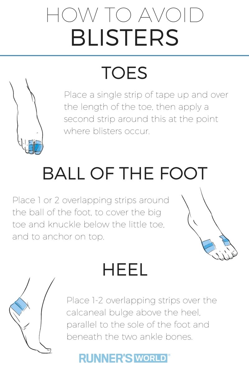 runnersworlduk's tweet photo. Escape the curse of blisters with these simple taping tips https://t.co/gCAwaFjeQk