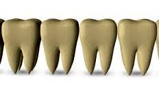 acrazydream36's tweet photo. Yellow #teeth no more! Come to the brighter side of #dentistry,naturally! #frommothersgarden https://t.co/5yIpslWu6M https://t.co/RX8OosTrsz