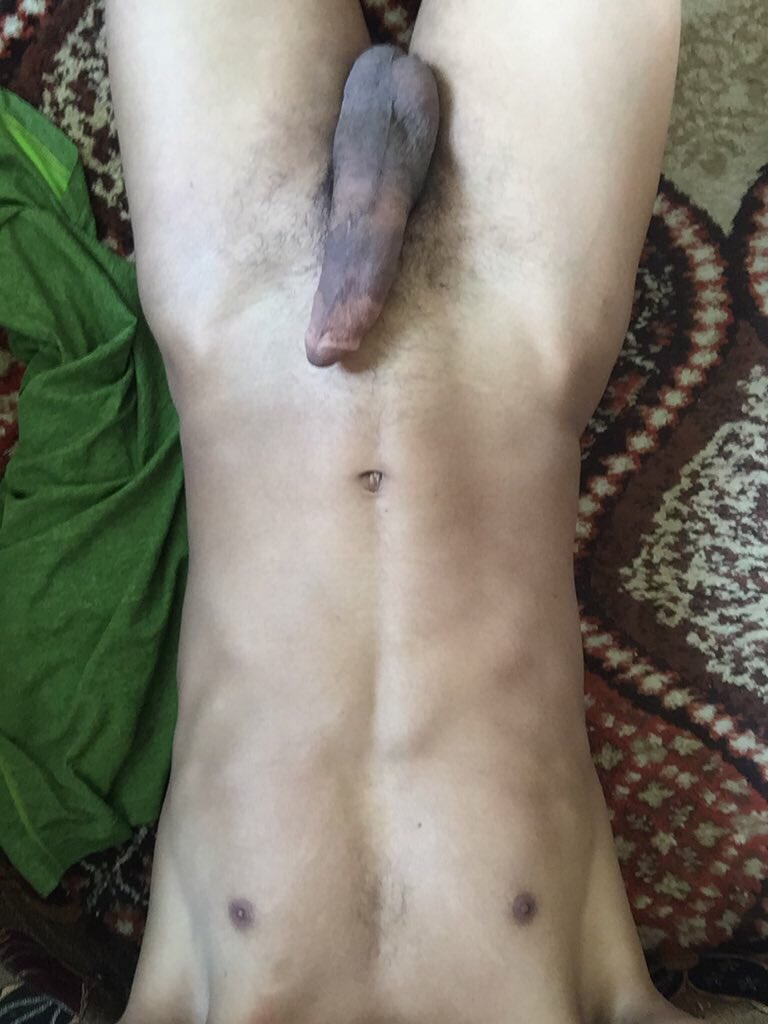 D2FE0879 الطايف موجب