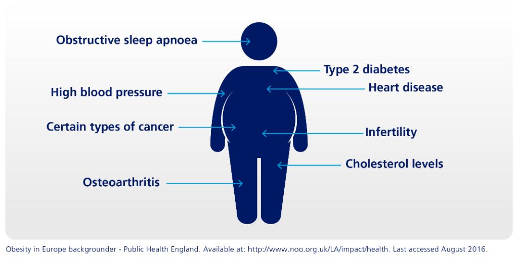 comorbidities of diabetes type 2