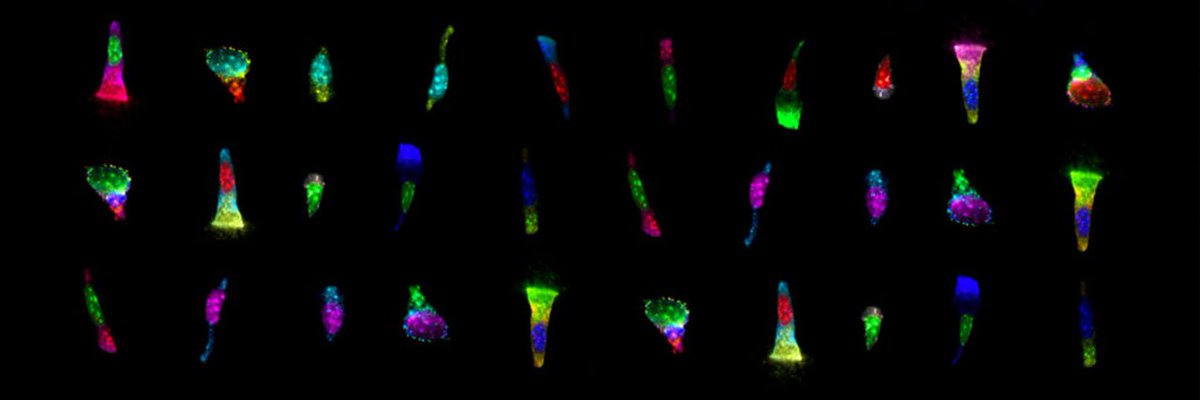 scisignal's tweet photo. Single-cell analysis of tumor samples to better inform treatment strategies for heterogeneous cancers #SciSig https://t.co/RUI4Qb42BH https://t.co/Qnx1YCQDu5