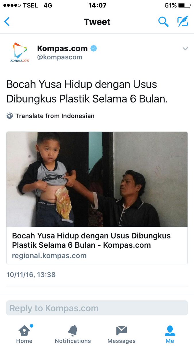 andi_chairil's tweet photo. Alhamdulillah.. Tuips, dana donasi utk Yusa sdh terkumpul Rp. 24,2 juta. Tq atas bantuannya. Barakallah | @PartaiSocmed @GDSuhendra https://t.co/jpndOpMfrV
