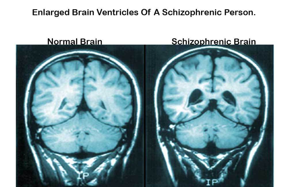 Brainmaya tweet picture