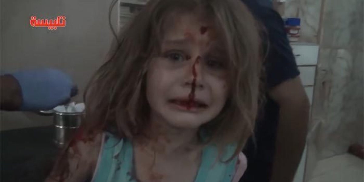 폭격당한 시리아 소녀는 애타게 아빠를 찾았다(동영상) huff.to/2e4TY1X