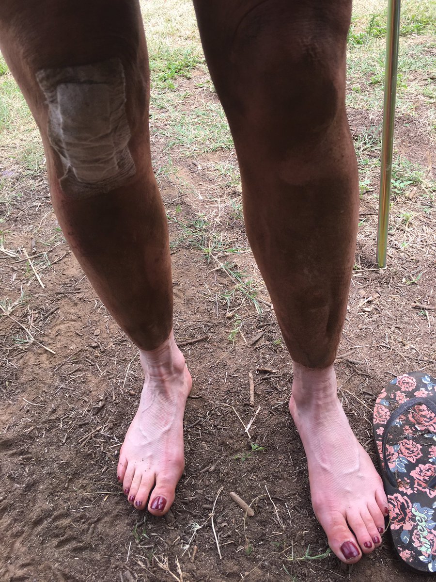 Tall_Dutch's tweet photo. @bergandbush #centriq Got to love the legs after eating some dust on stage 2! @tashbashtango https://t.co/OyuooR7bo3