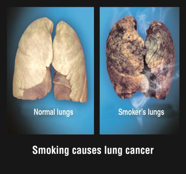 7 out of the 47 countries in the WHO African Region have implemented pictorial health warnings on #tobacco packages. #NoTobacco